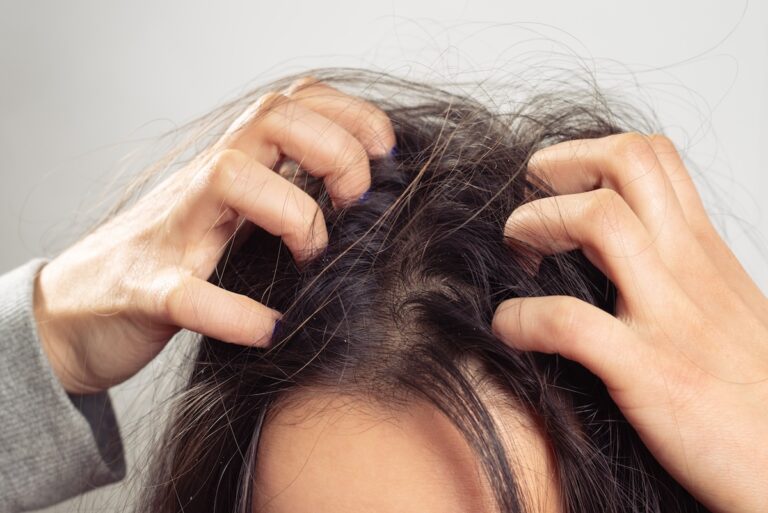 a young woman scratches her scalp and hair